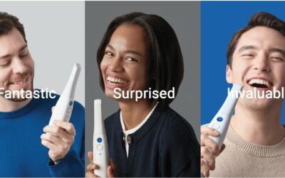 Le impronte non sono più un “incubo”.